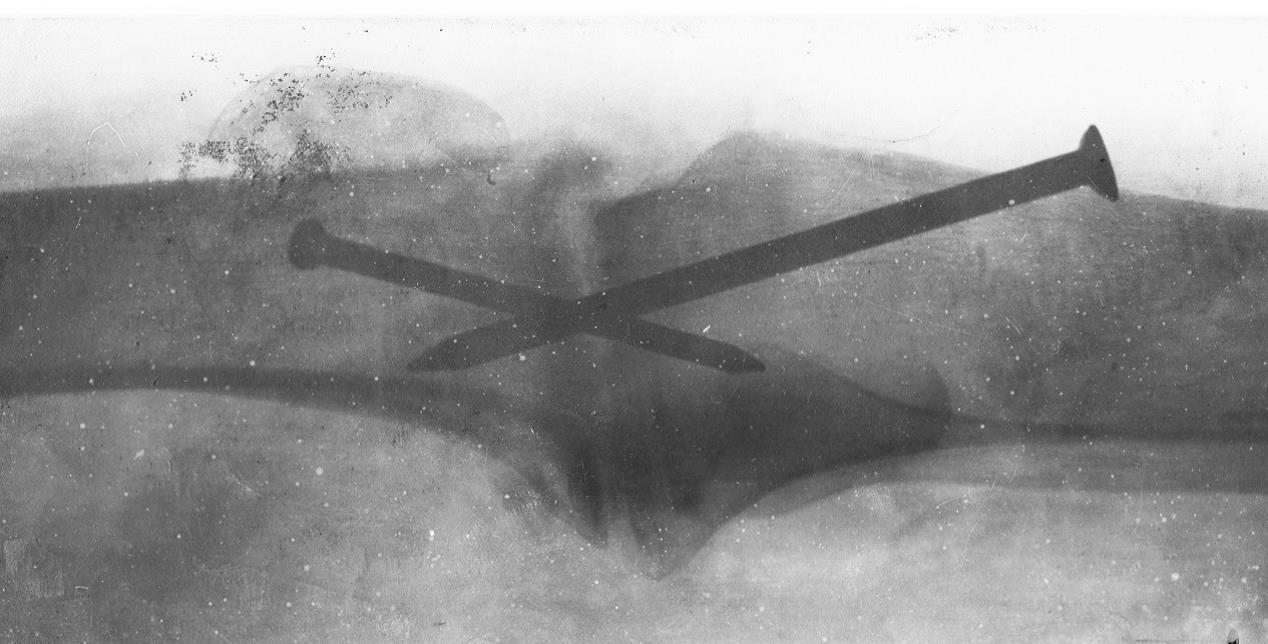 Nail xray.jpg